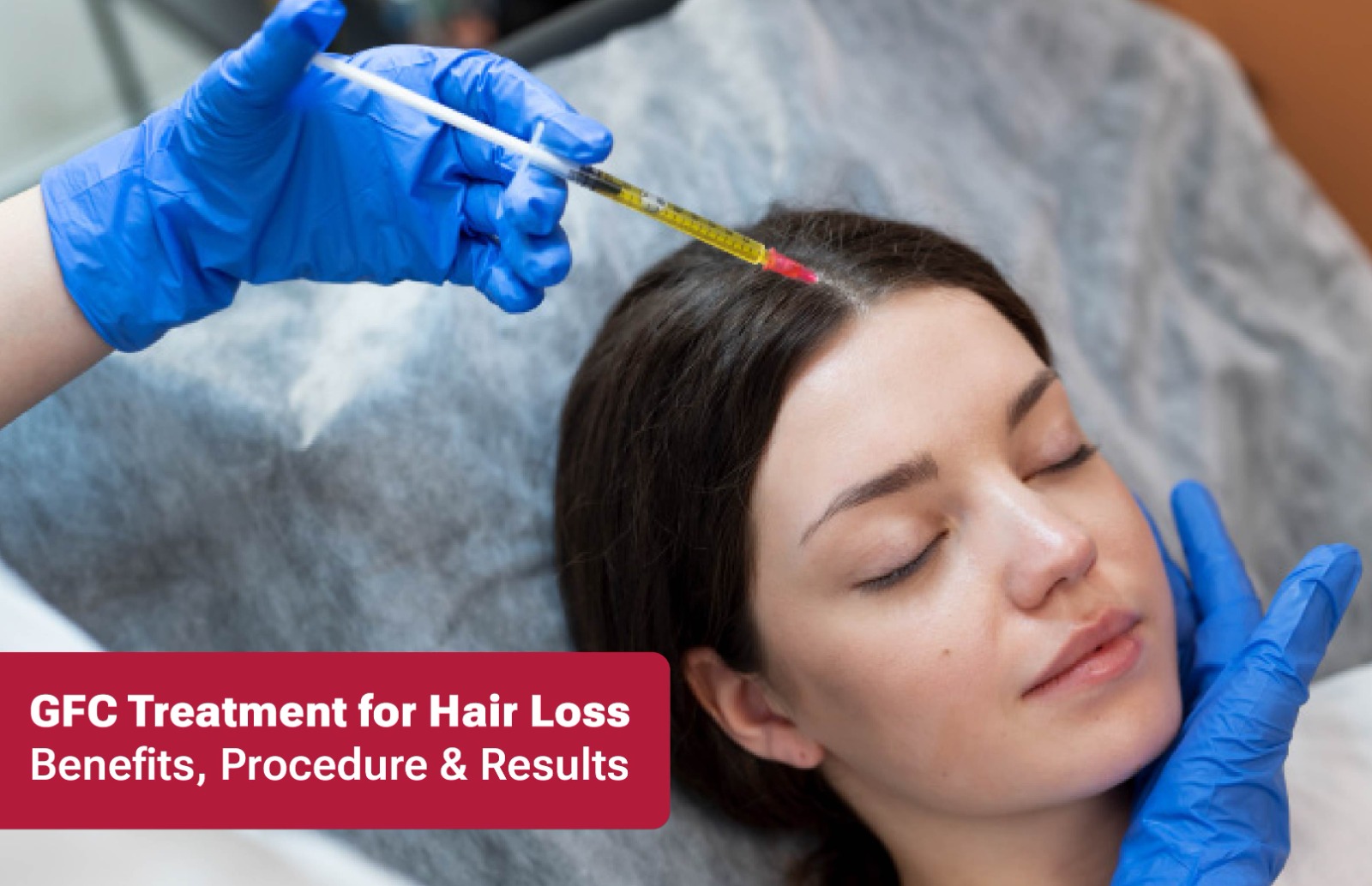 GFC Treatment for Hair Loss: Benefits, Procedure & Results