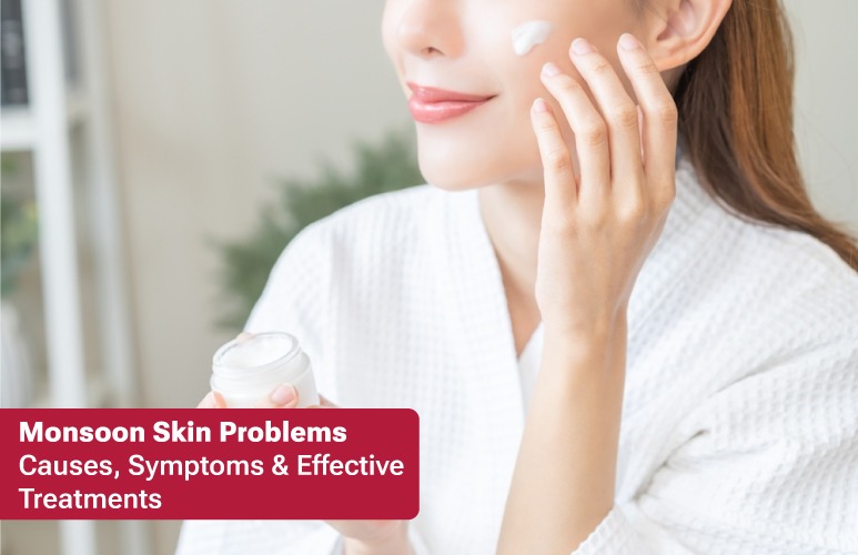 Monsoon Skin Problems: Causes, Symptoms & Effective Treatments